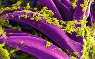 What is pneumonic plague, and how will we know if it’s spreading in Russia?
